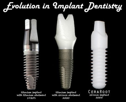 ceramic dental implant claremont ca metal free ceramic dental implant 