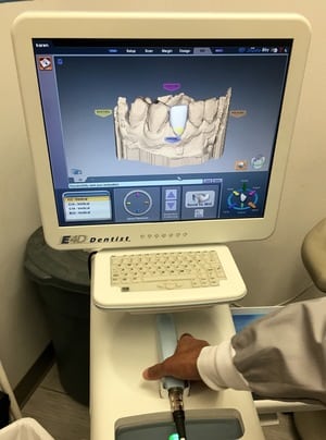 same-day dental crowns in our Claremont dental office