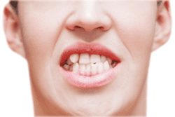 Why Crooked Teeth Need To Be Corrected Immediately