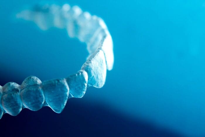 Invisible Braces for Adults