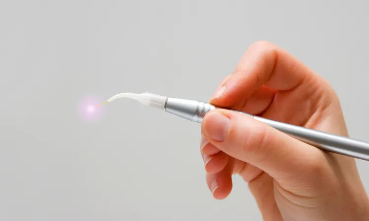 How Solea Laser Changes Cavity Treatment in Claremont, CA